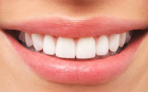 Diastema