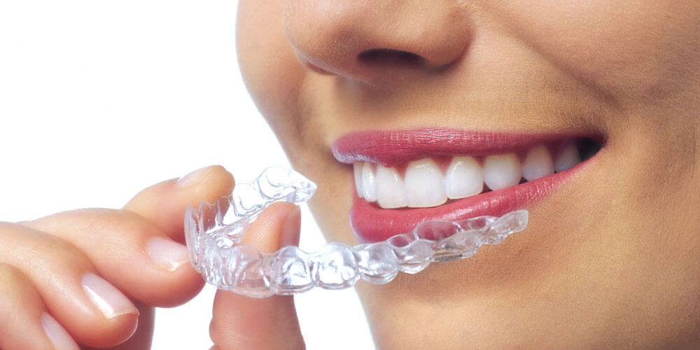 Invisalign Treatment